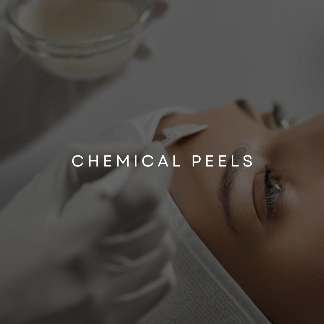 Chemical Skin Peel Treatments